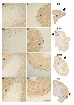 A Survey of White Matter Neurons at the Gyral Crowns and Sulcal Depths in the Rhesus Monkey